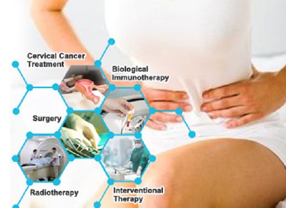 cervical cancer treatment