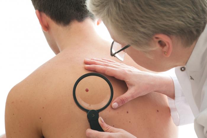  Inflammatory Skin Diseases Treatment